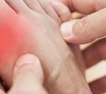 The feet of a man suffering from gout.