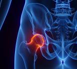 Illustration of a human hip joint