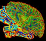 SumaLateral Whole Brain Image