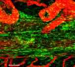 Confocal micrograph showing the superior saggital sinus in the mouse. Immune cells are shown in green lining this tube, and blood vessels in red