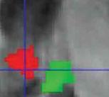 Functional MRI scan
