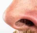 Close-up of someone's nose