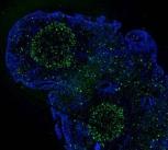 Cell nucleus before and after treatment with Remodelin