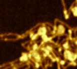Image of “amyloid fibrils”; thread-like structures which form after the protein alpha-synuclein aggregates. Plaques (protein deposits) consisting of this protein have been found in the brains of Parkinson ’s Disease patients and linked to disease.