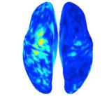 Measurement of brain activity in a patient with phantom limb pain