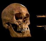 Skull and bones of Richard III