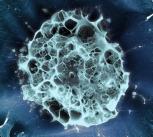 Human stem cell embedded in a 3D matrix, Cryo SEM