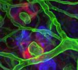 Stem cells