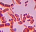 Bacteria