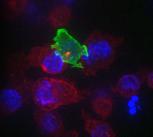 Killer T-Cell