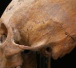 Example of a modified skull, a practice assumed to be Hunnic that may have been appropriated by local farmers within the bounds of the Western Roman Empire.