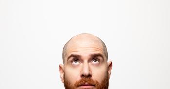 Bald young man, front view 