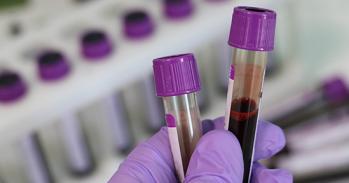 Blood samples