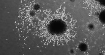 Microscopic image of placental organoids