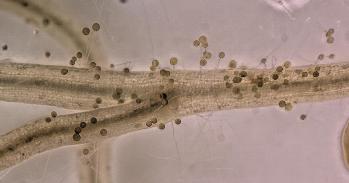 Plant roots interacting with arbuscular mycorrhizal fungi. Image: Luginbuehl lab