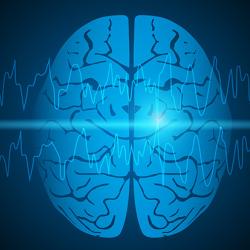 Visual representation of focal epilepsy