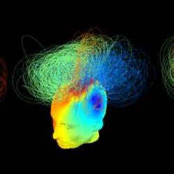 Electrical brain 'signatures'. The patient to the left is in a vegetative state; the patient in the middle is also in a vegetative state but their brain appears as conscious as the brain of the healthy individual at the right.