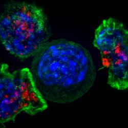 Killer T cells surround a cancer cell
