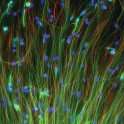 human neural stem cells 
