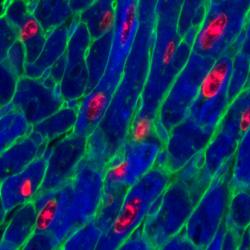 Adult mouse heart muscle cells (blue) after activation of both proteins vital for cell replication. Red shows cells replicating, green marks cell membrane.