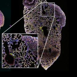 Lung with two metastatic lesions derived from a mouse primary triple-negative breast tumour