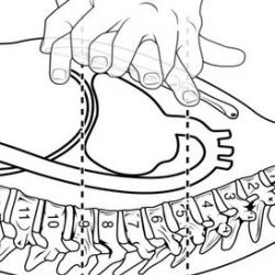 Cardio-pulmonary resuscitation