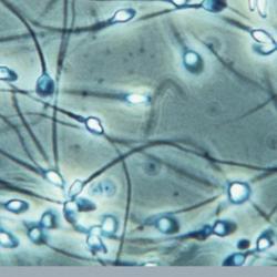 Sperm cells