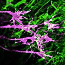 Growth cones of retinal axons (purple) growing among cells in the brain (green)
