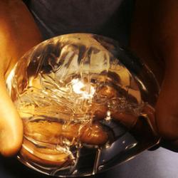 Breast implant