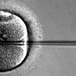 ICSI sperm injection into oocyte