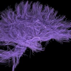 Brain Art