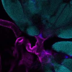 The reproductive machinery of Drosophila melanogaster. Two ovaries (upper right) connected by the oviduct.