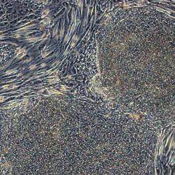 Human embryonic stem cell colonies