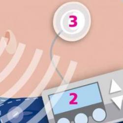Artificial pancreas