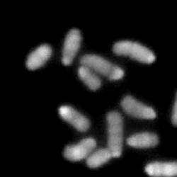 Partial view of haploid chromosome set 