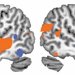 Functional neuroimaging of the human brain