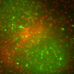 Image of a cell with AP-5 showing in green, AP-1 and AP-2 in red.