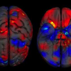 Overview of average regional sex differences in grey matter volume. Areas of larger volumes in women are in red and areas of larger volume in men are in blue. 