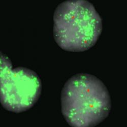 Multiple copies of the TRIM44 gene in an oesophageal cancer cell line