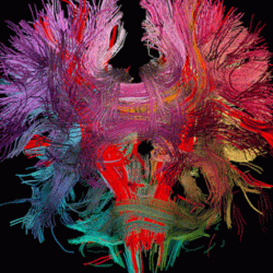 Neural Connections In the Human Brain
