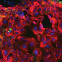 Breast cells grown in the laboratory for research on which cells in the breast form tumours
