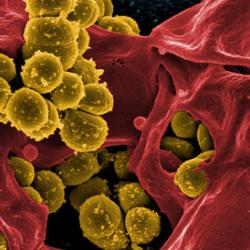 Micrograph of Methicillin-Resistant Staphylococcus aureus (MRSA)