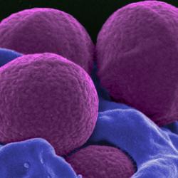 Methicillin-Resistant Staphylococcus aureus