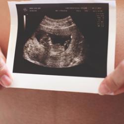 Pregnant