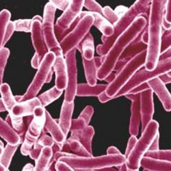 Mycobacterium tuberculosis