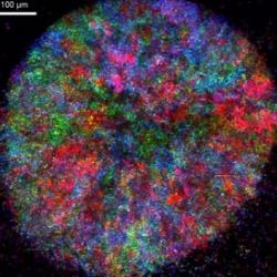 Metabolic cooperation in a social Baker’s yeast community. Pictured is a two-day old yeast community that grows as a colony. Different colours indicate cells producing and consuming different metabolites and nutrients.