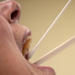 Taking a swab to test for SARS-CoV-2 (COVID-19)