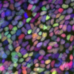 Stem cells