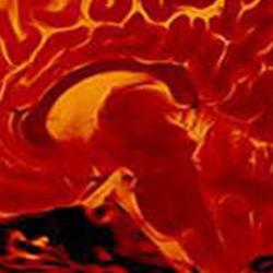 Brain scan
