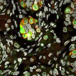Developing human primordial germ cells (each small green and red cell is a PGC)